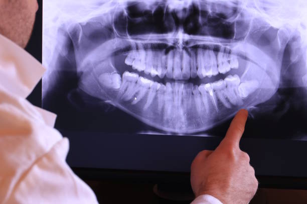 Best Knocked-Out Tooth Emergency  in East Rockingham, NC