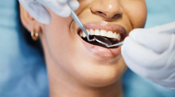 Best Knocked-Out Tooth Emergency  in East Rockingham, NC